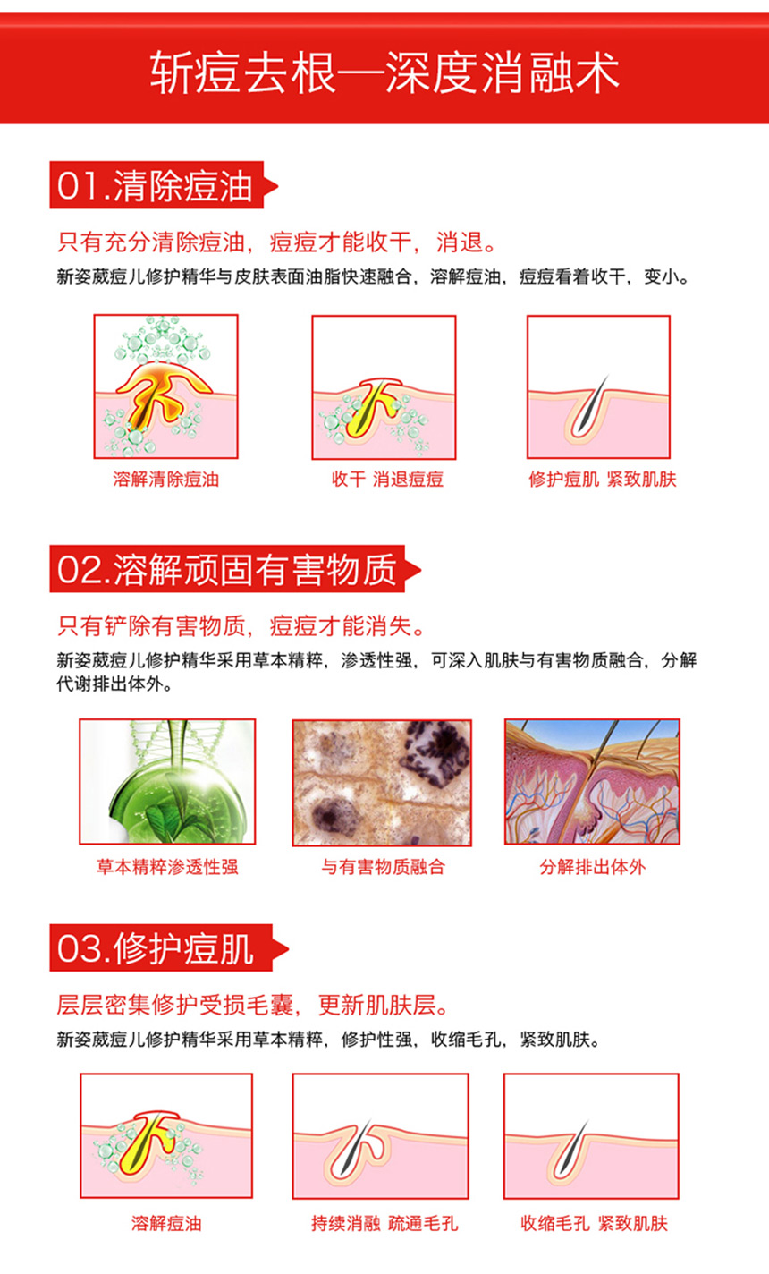 痘儿修护精华（女士）860详情图_07.jpg
