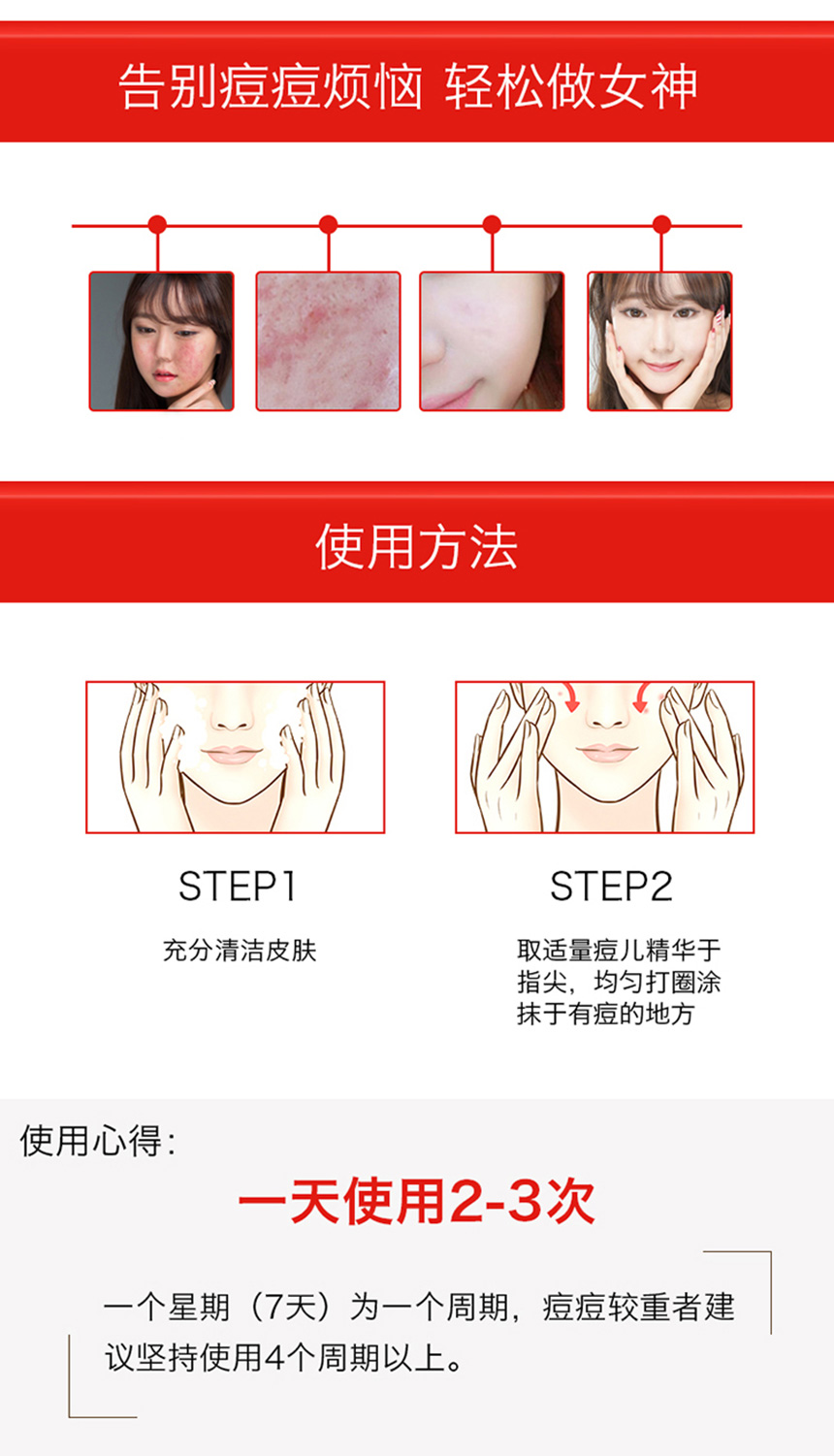 痘儿修护精华（女士）860详情图_08.jpg
