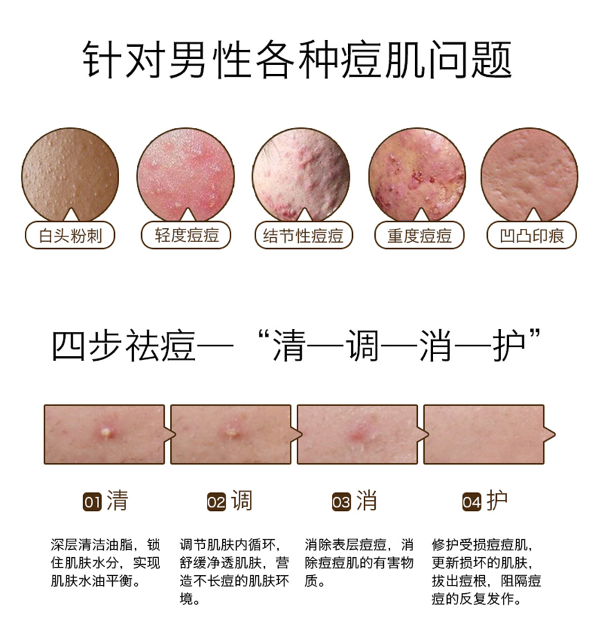 男士痘儿修护精华860详情图_05.jpg