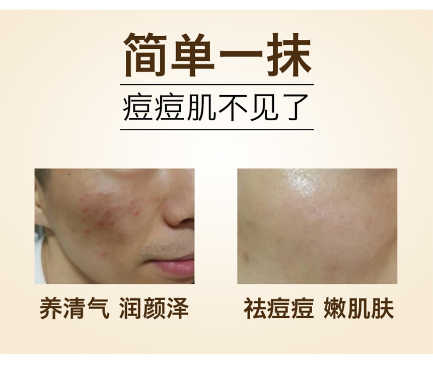 男士痘儿修护精华860详情图_07.jpg